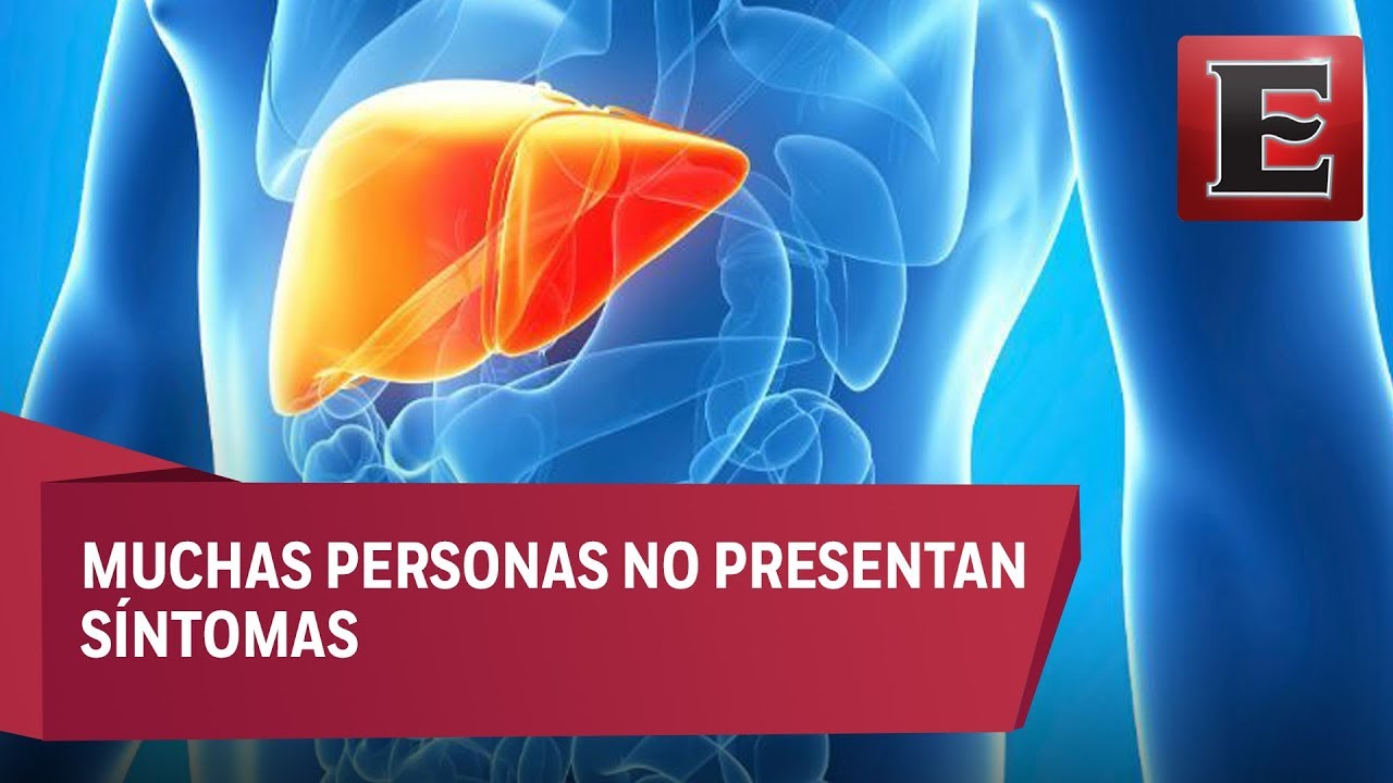 qué es la hepatitis cy cuáles son sus síntomas