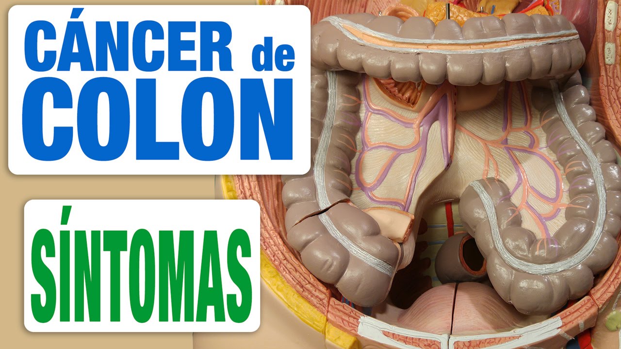 qué síntomas tiene el cáncer de colon